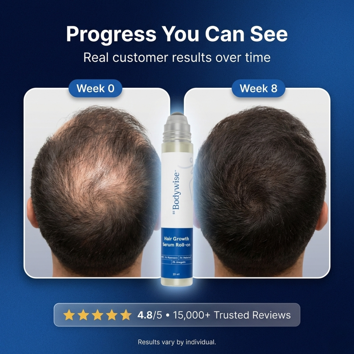 Flary™ Hair Growth Serum
